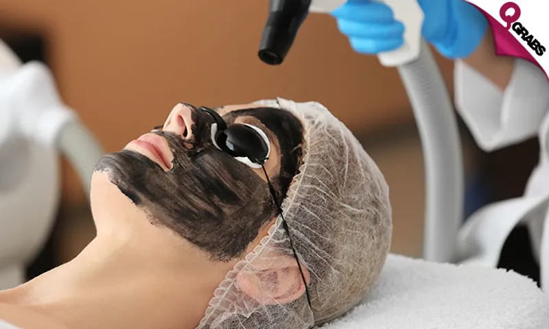 Spectra Carbon Laser Treatments for Ladies & Men!